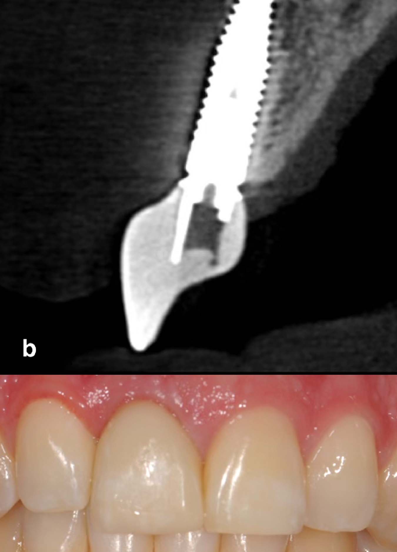 anatomy_socket_site